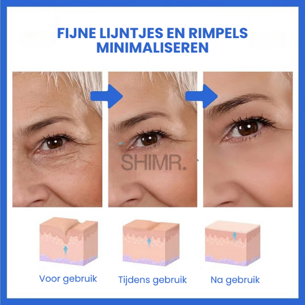 SkinLift™ | Botox Gezicht Serum