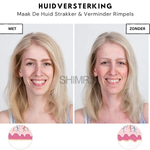 SkinLift™ | Botox Gezicht Serum