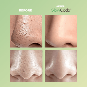 GlowCado™ - Avocado Face Masker