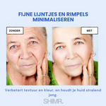 SkinLift™ | Botox Gezicht Serum