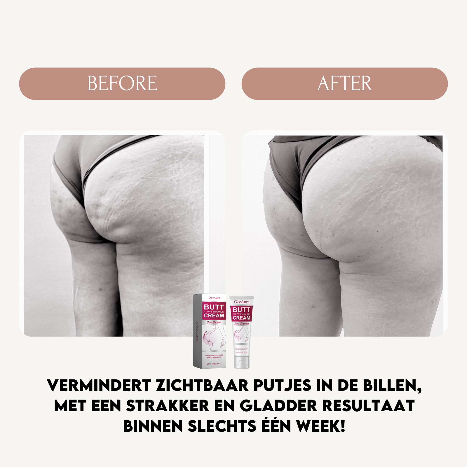 SHIMR Crème l Voor stevige en mooie billen!